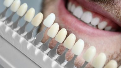 بهترین برند کامپوزیت دندان