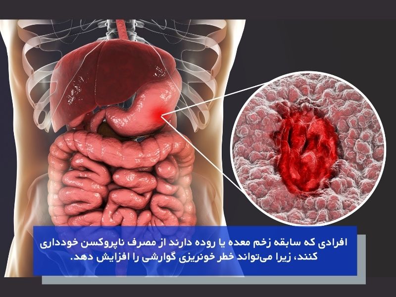 موارد منع مصرف ناپروکسن