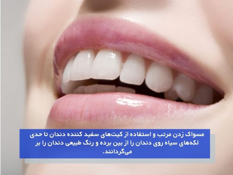 درمان لکه های سیاه دندان با مسواک زدن