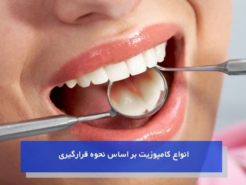 انواع کامپوزیت بر اساس نحوه قرارگیری