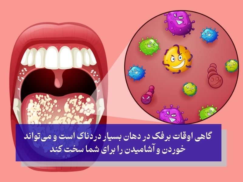 نشانه‌های برفک در دهان بزرگسالان