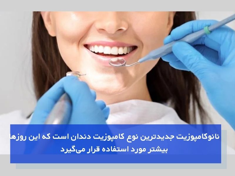 ایدهآلترین نوع کامپوزیت دندان