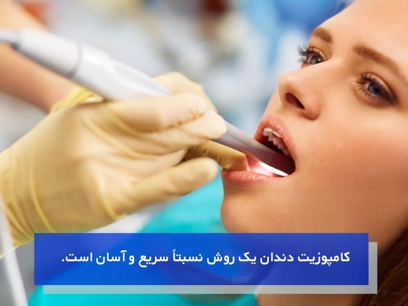 مزیت کامپوزیت دندان