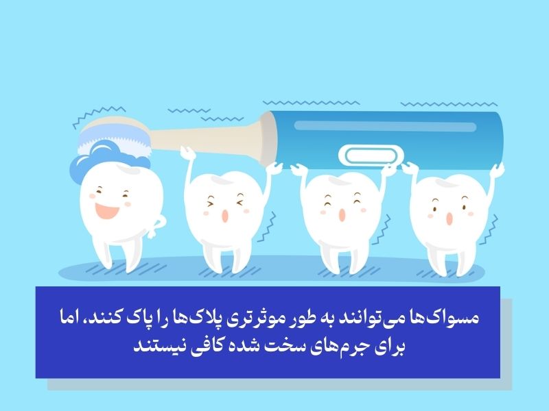 جرم گیری دندان خانگی