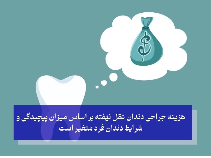 هزینه جراحی دندان عقل
