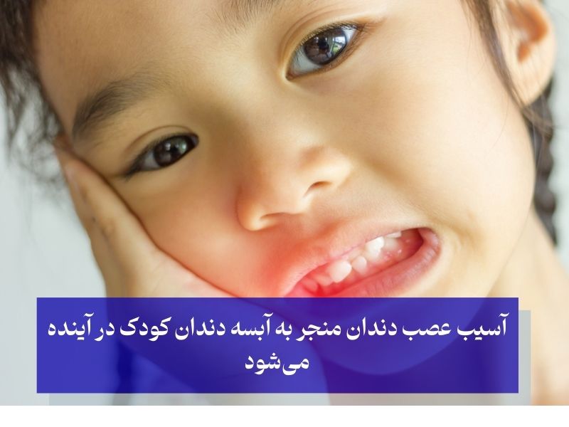 آبسه دندان شیری