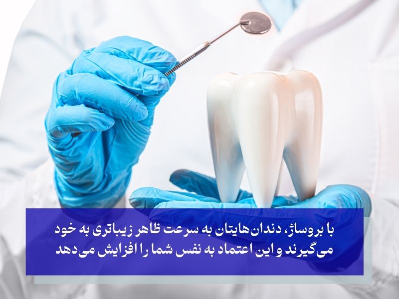 مزایای بروساژ دندان