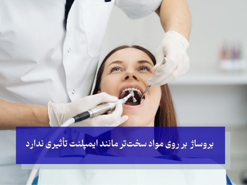 بروساژ ایمپلنت