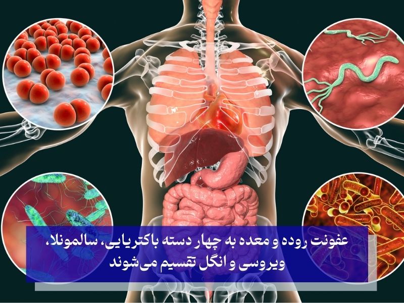 انواع عفونت روده و معده