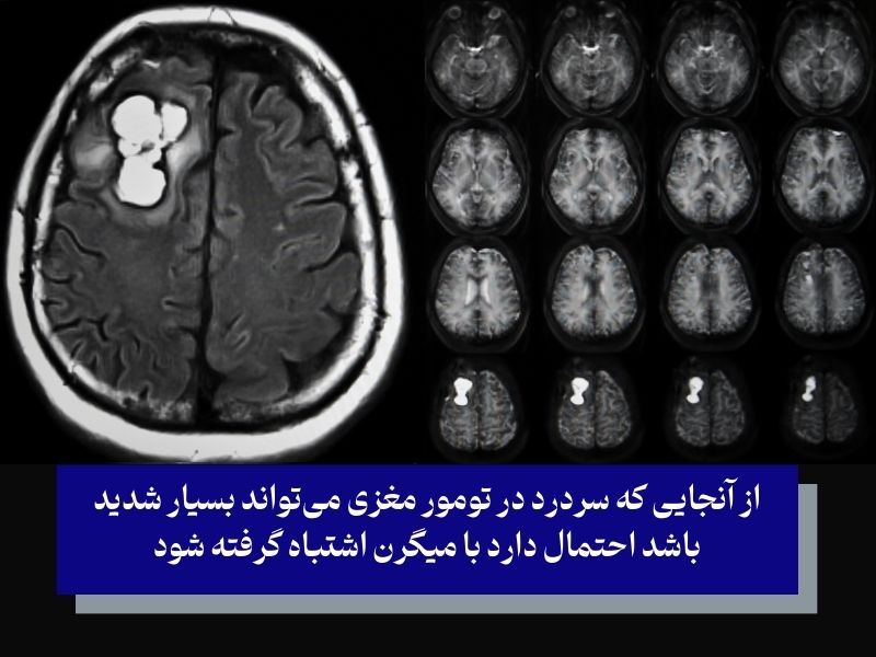 شایعترین علائم تومور مغزی