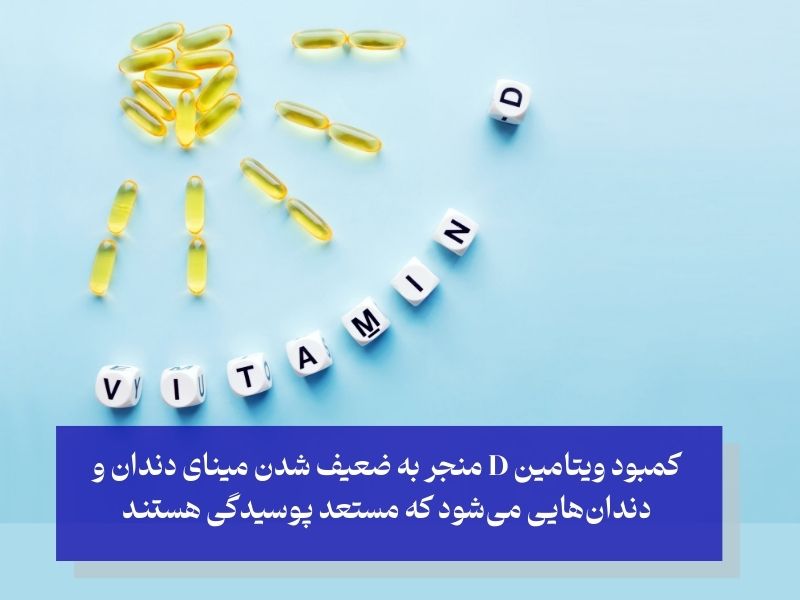 کمبود ویتامین D و ضعیف شدن مینای دندان