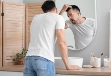 درمان خانگی ریزش مو شدید