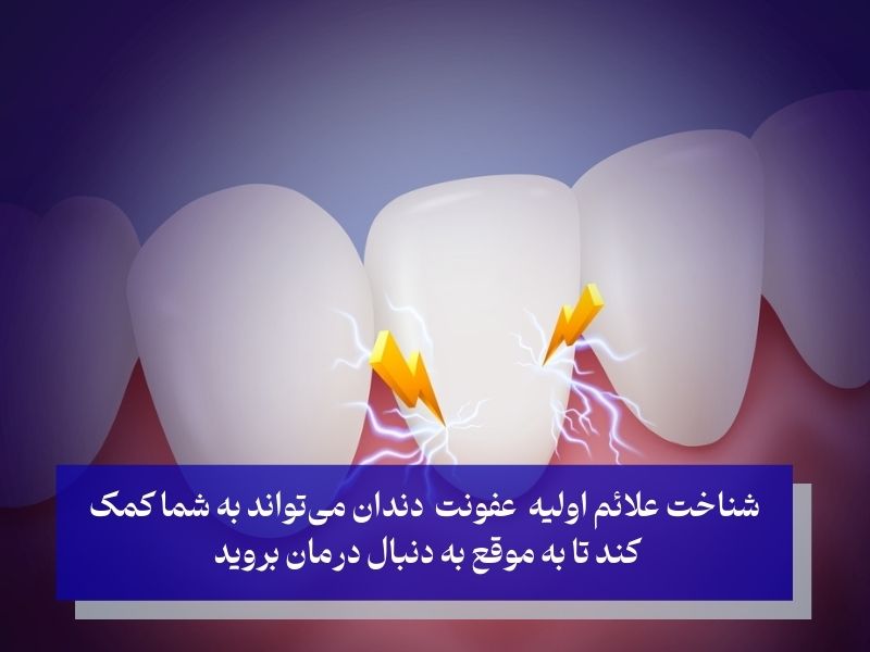 علائم اولیه عفونت دندان