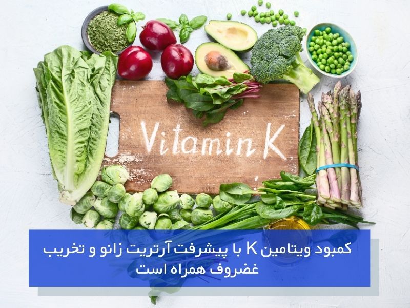 زانو درد و کمبود ویتامین K