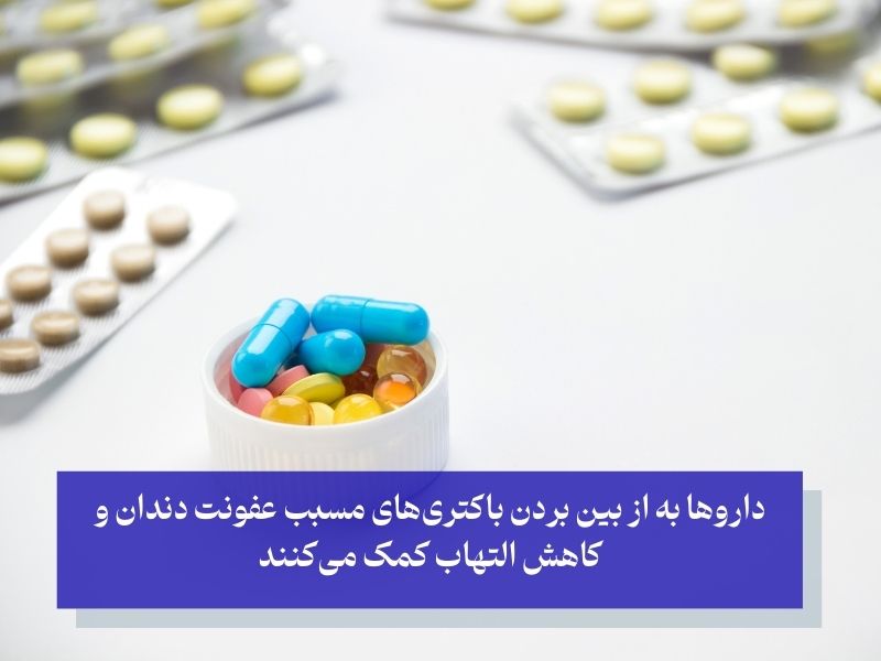 داروها برای عفونت دندان