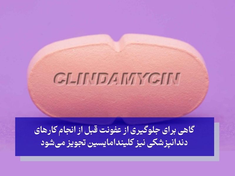 کلیندامایسین قرص چرک خشک کن قوی برای عفونت دندان