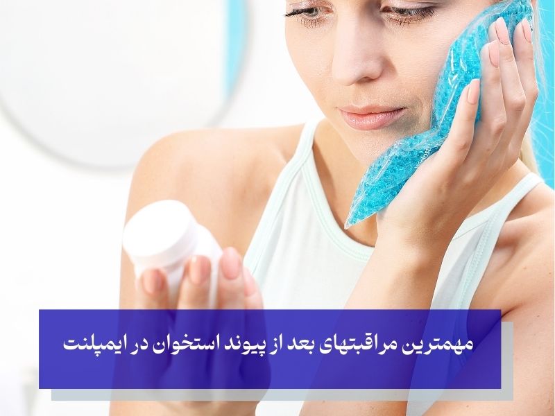 مراقبتهای بعد از پیوند استخوان در ایمپلنت