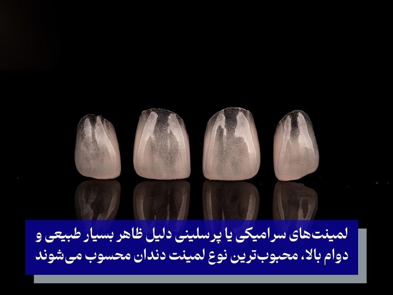 لمینتهای سرامیکی