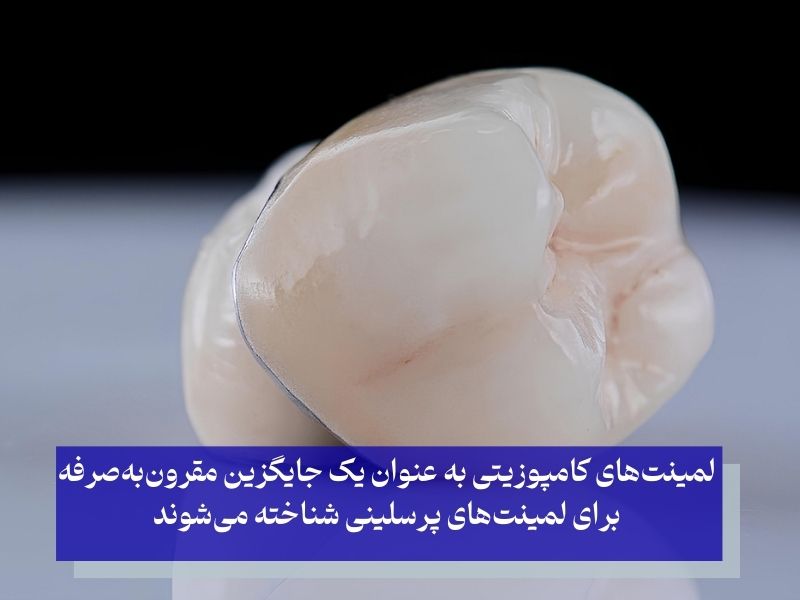 لمینتهای رزین کامپوزیتی