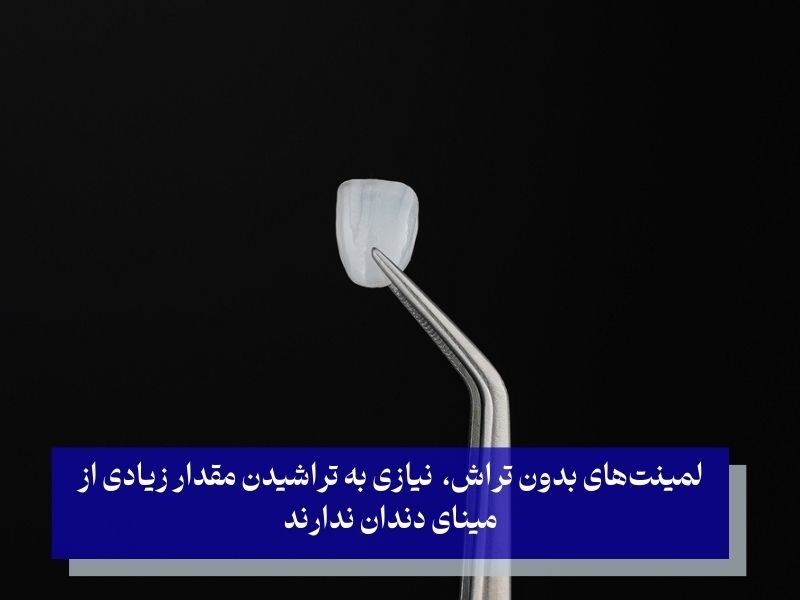 لمینتهای بدون تراش