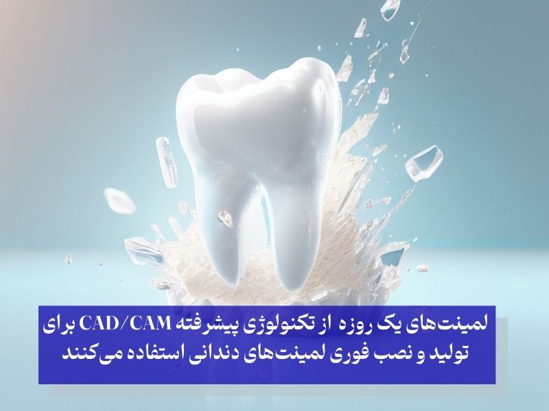 لمینتهای یک روزه