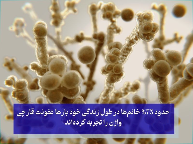 عفونت قارچی واژن