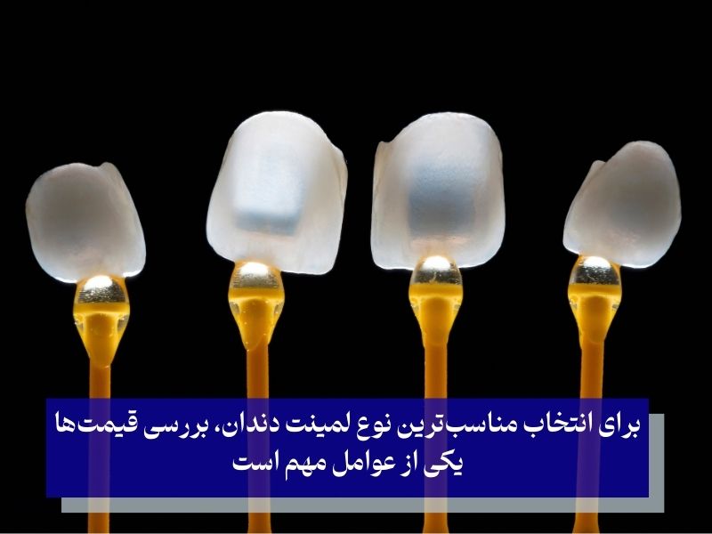 قیمت انواع لمینت دندان