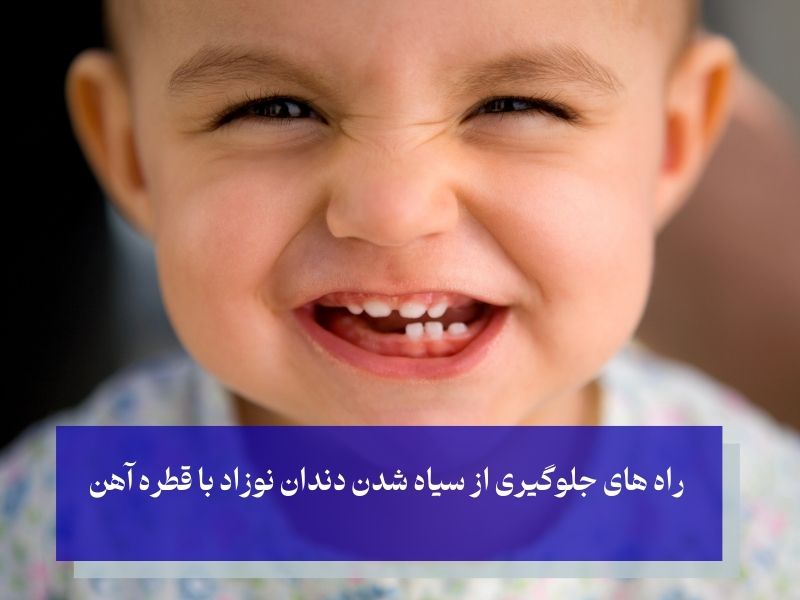 راه های جلوگیری از سیاه شدن دندان نوزاد با قطره آهن