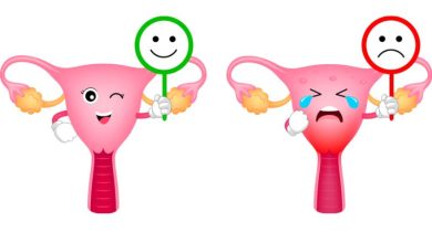 درمان زخم دهانه رحم