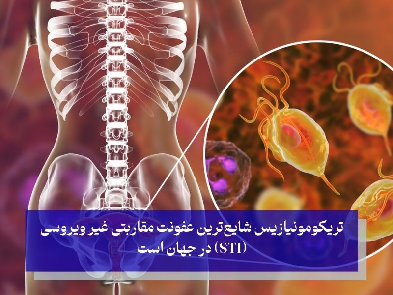 شایعترین عفونت مقاربتی غیر ویروسی
