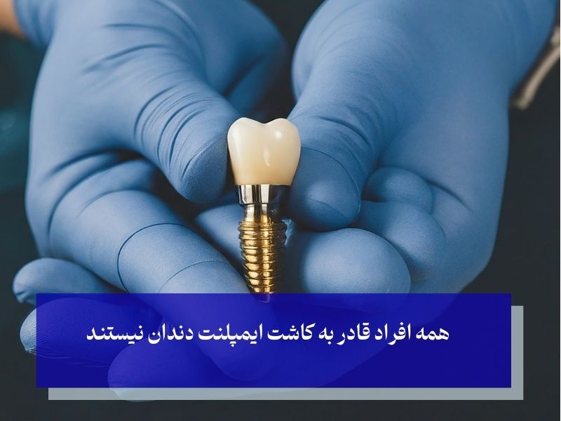 آیا همه افراد می‌توانند ایمپلنت انجام دهند