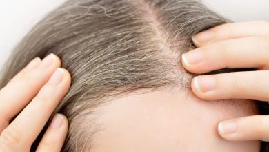 جلوگیری از سفید شدن مو