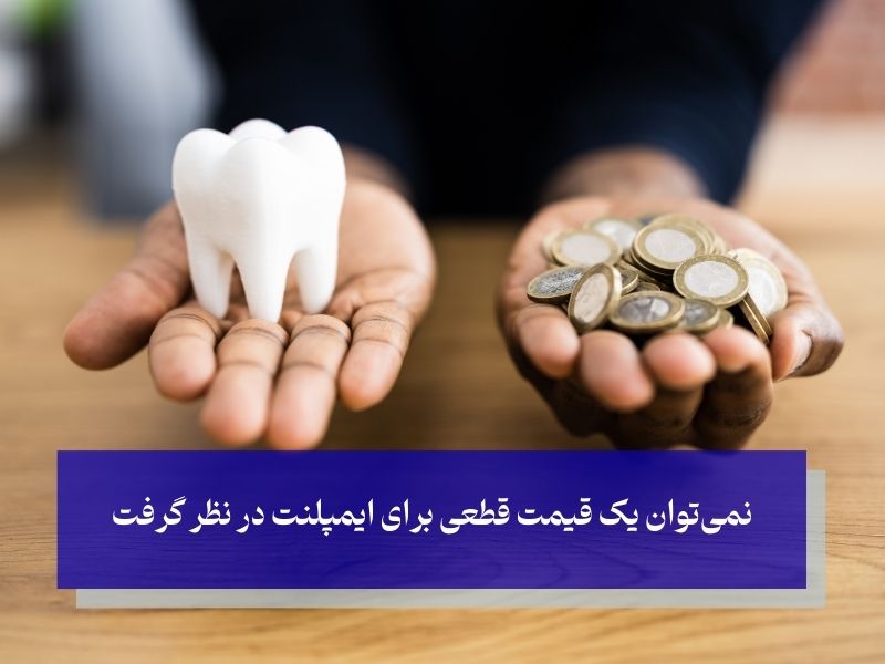 قیمت ایمپلنت دندان