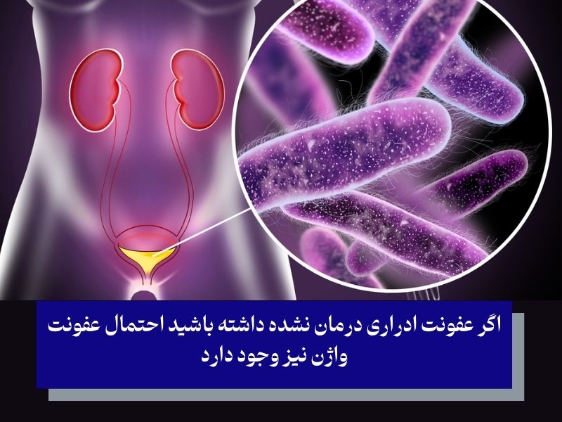 عفونت ادراری و ارتباطش با بوی بد واژن