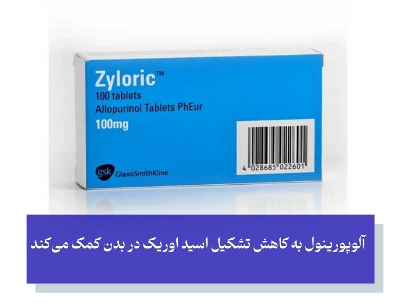 قویترین قرص برای دفع سنگ کلیه آلوپورینول
