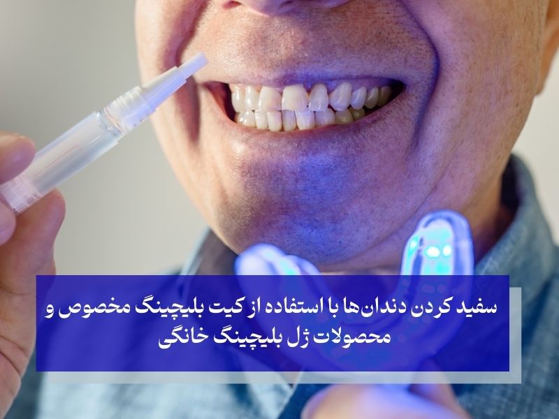 ابزارهای مورد نیاز برای سفید کردن دندان در خانه