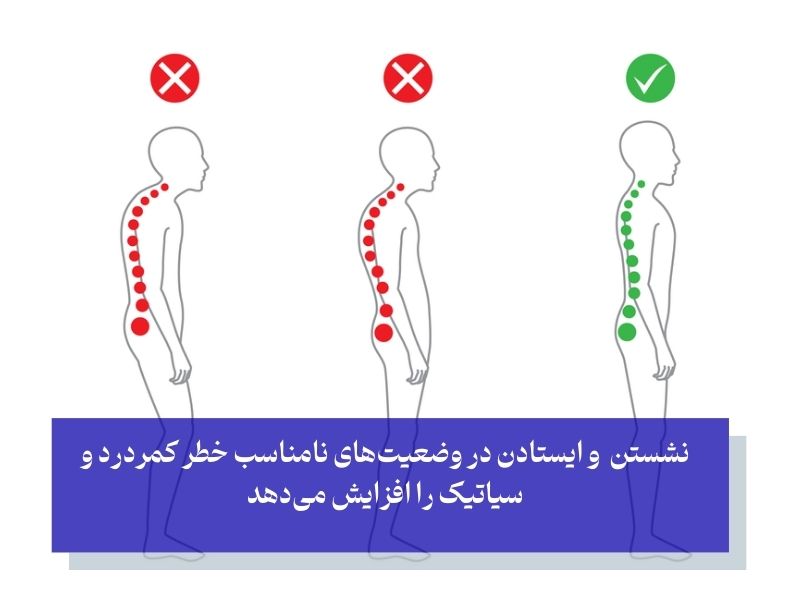 حفظ انحنای طبیعی ستون فقرات برای کاهش درد سیاتیک