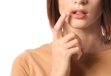 رفع تبخال در سه دقیقه