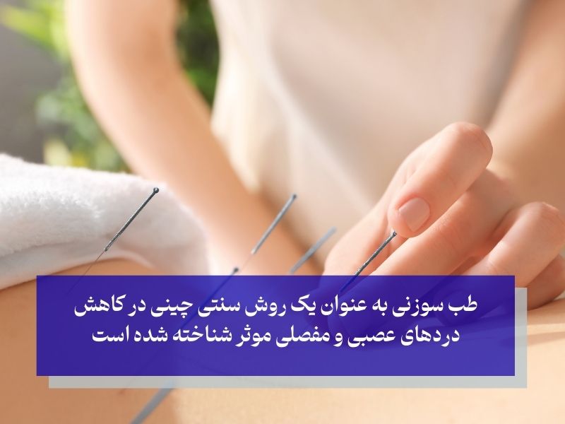 طب سوزنی برای کاهش درد سیاتیک