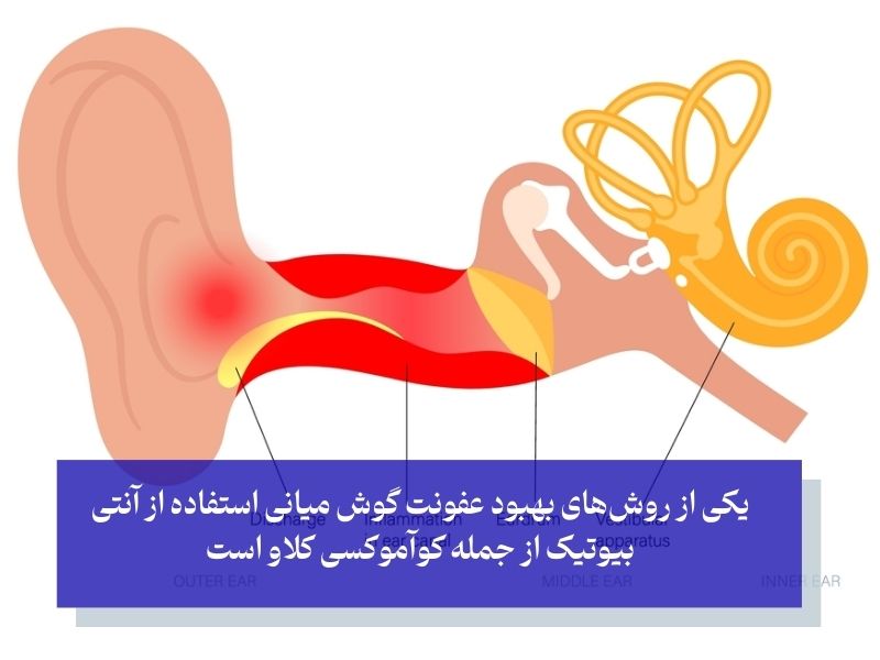 مصرف آموکسی کلاو برای عفونت گوش میانی