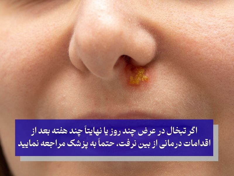 هنگام تبخال چه کارهایی را نباید انجام داد