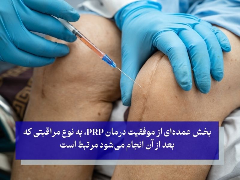 چرا مراقبت ‌های بعد از پی آر پی زانو اهمیت دارند