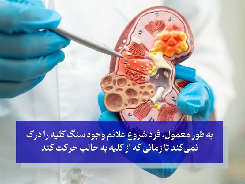 علائم سنگ کلیه