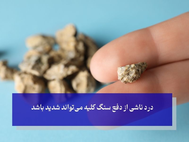 دردهای همراه با دفع سنگ کلیه