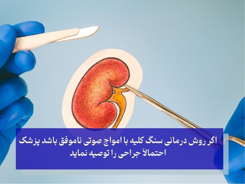 روش جراحی برای درد سنگ‌ کلیه