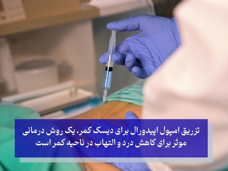 تزریق‌های اپیدورال برای کاهش فوری درد پارگی دیسک کمر