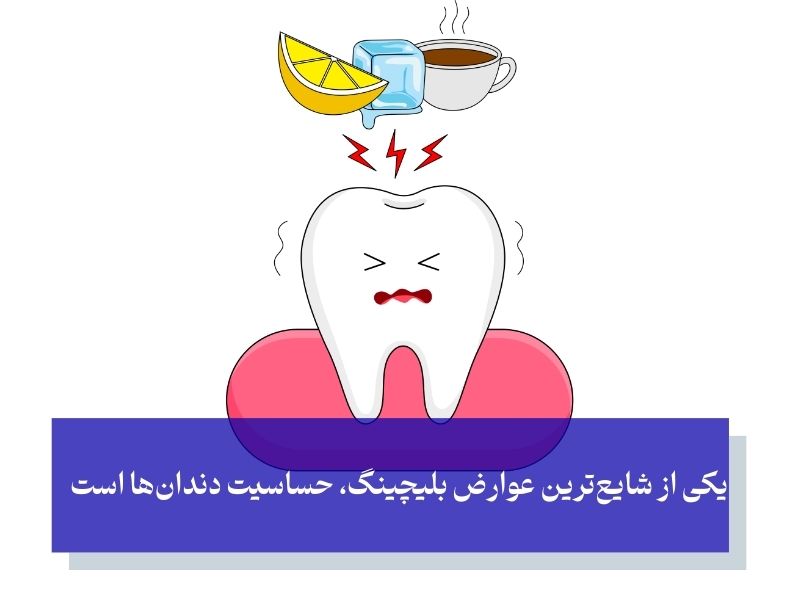 آیا بلیچینگ دندان عوارضی دارد