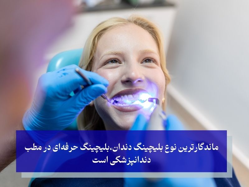 انواع روش‌های بلیچینگ