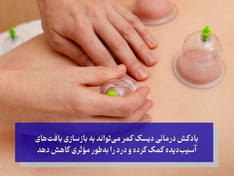 بادکش درمانی دیسک کمر