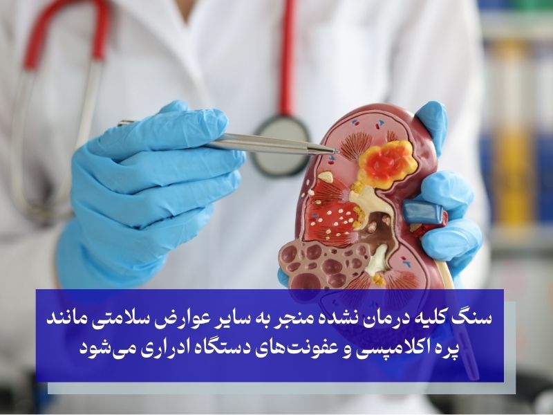 آیا سنگ کلیه در بارداری خطرناک است